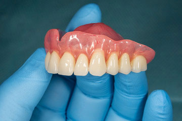 Denture Stabilisation